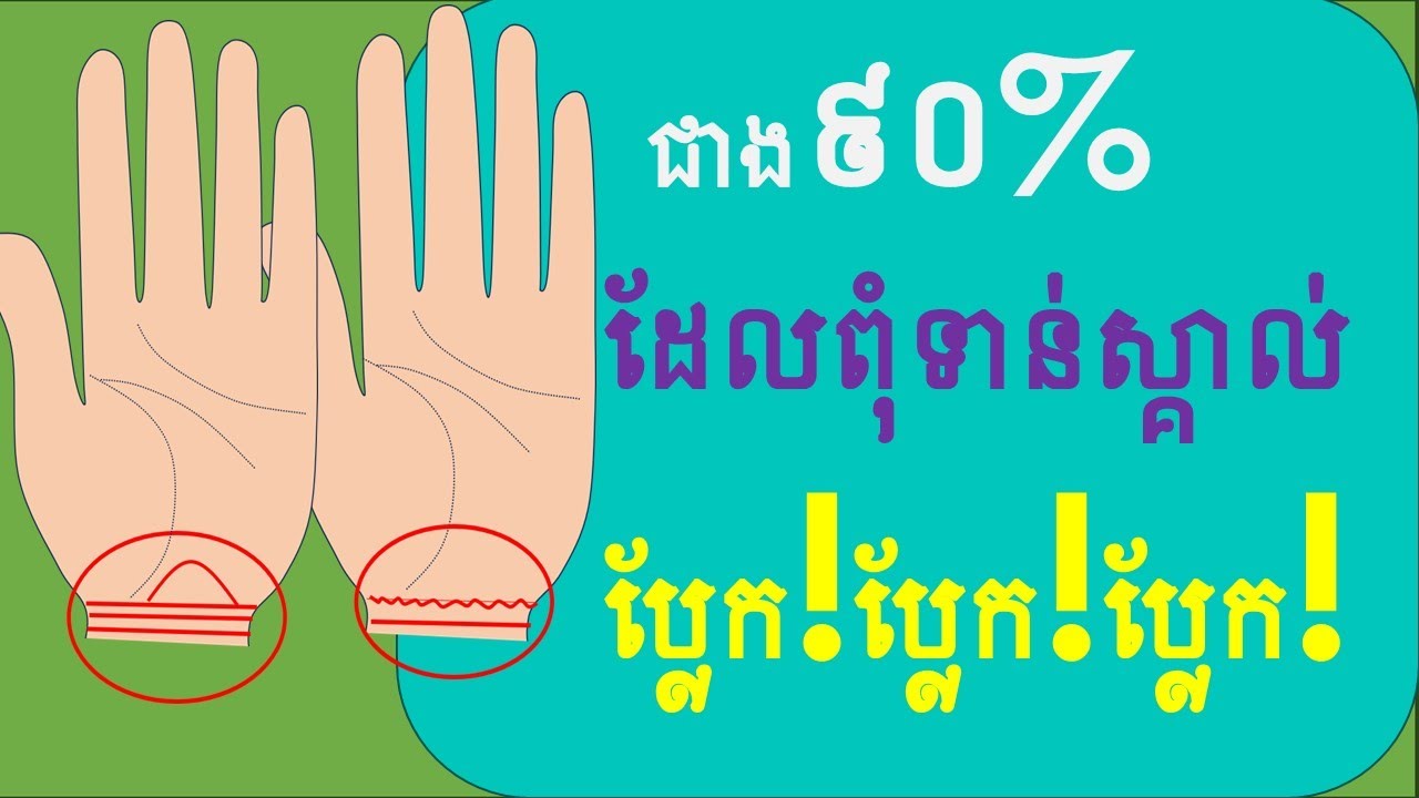 ខ្សែដែលមាននៅលើកដៃជាខ្សែពិសេសហើយប្លែកមាន5ចំណុច