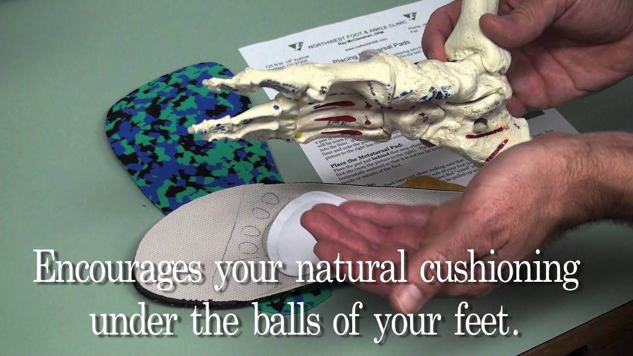 How to Place Metatarsal Pads