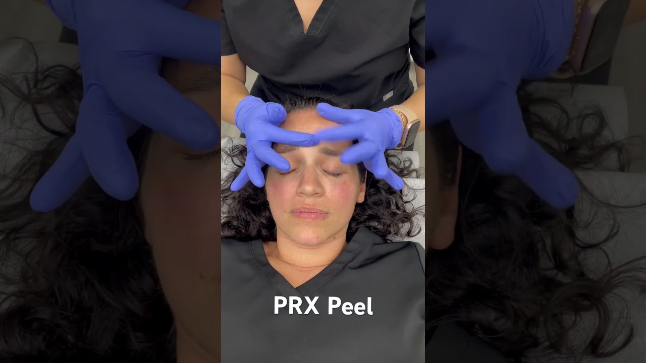 #PRX peel with NO downtime! Perfect for every skin type