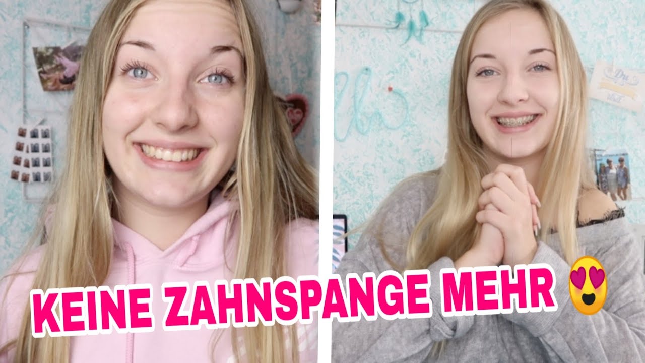 ENDLICH!! 😍SO sehe ich OHNE ZAHNSPANGE aus 😍