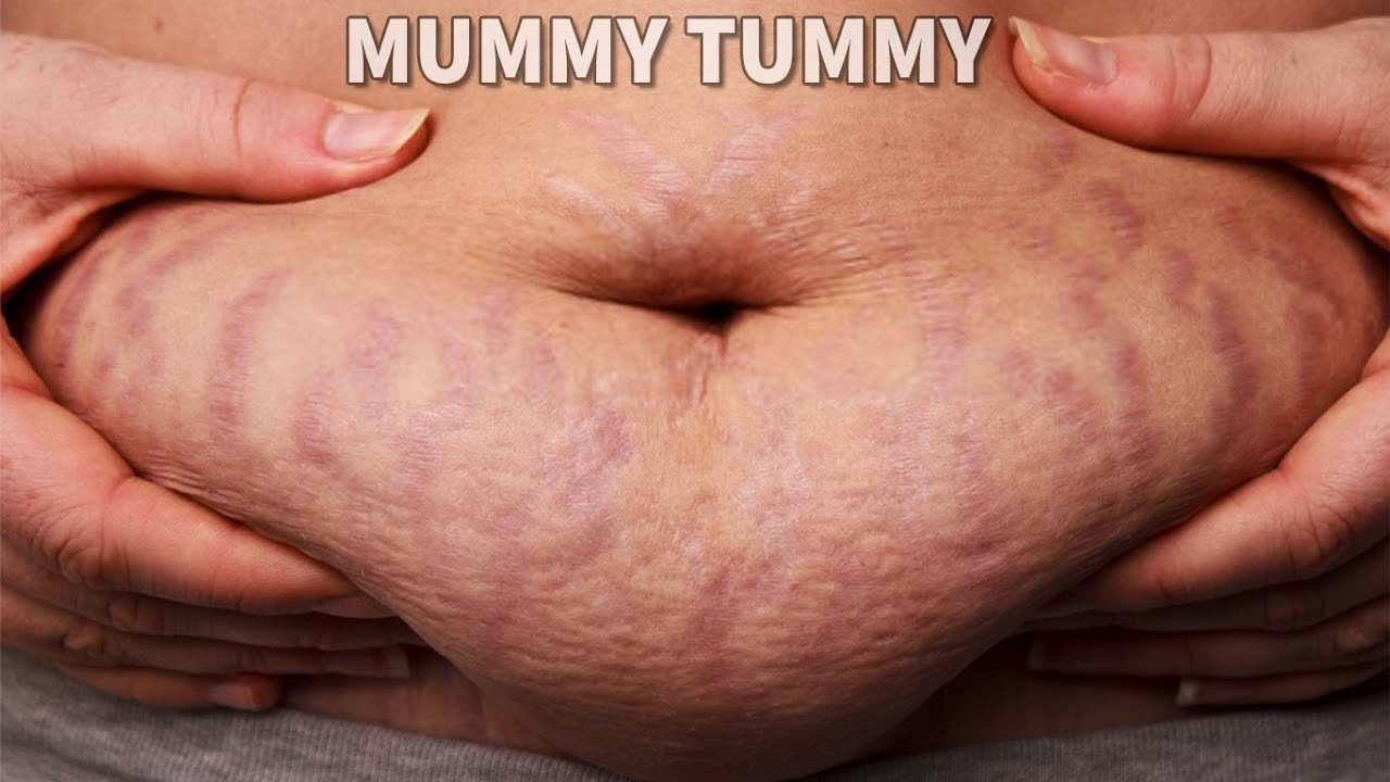 DAY 3 | RESET MUMMY TUMMY & BODY | COMPLETE RECOVERY PLAN