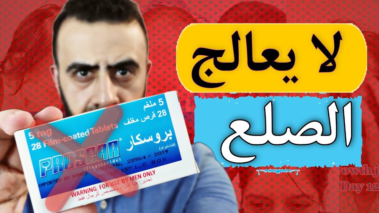 الفيناسترايد لا يعالج الصلع الوراثي كما يقول الاطباء