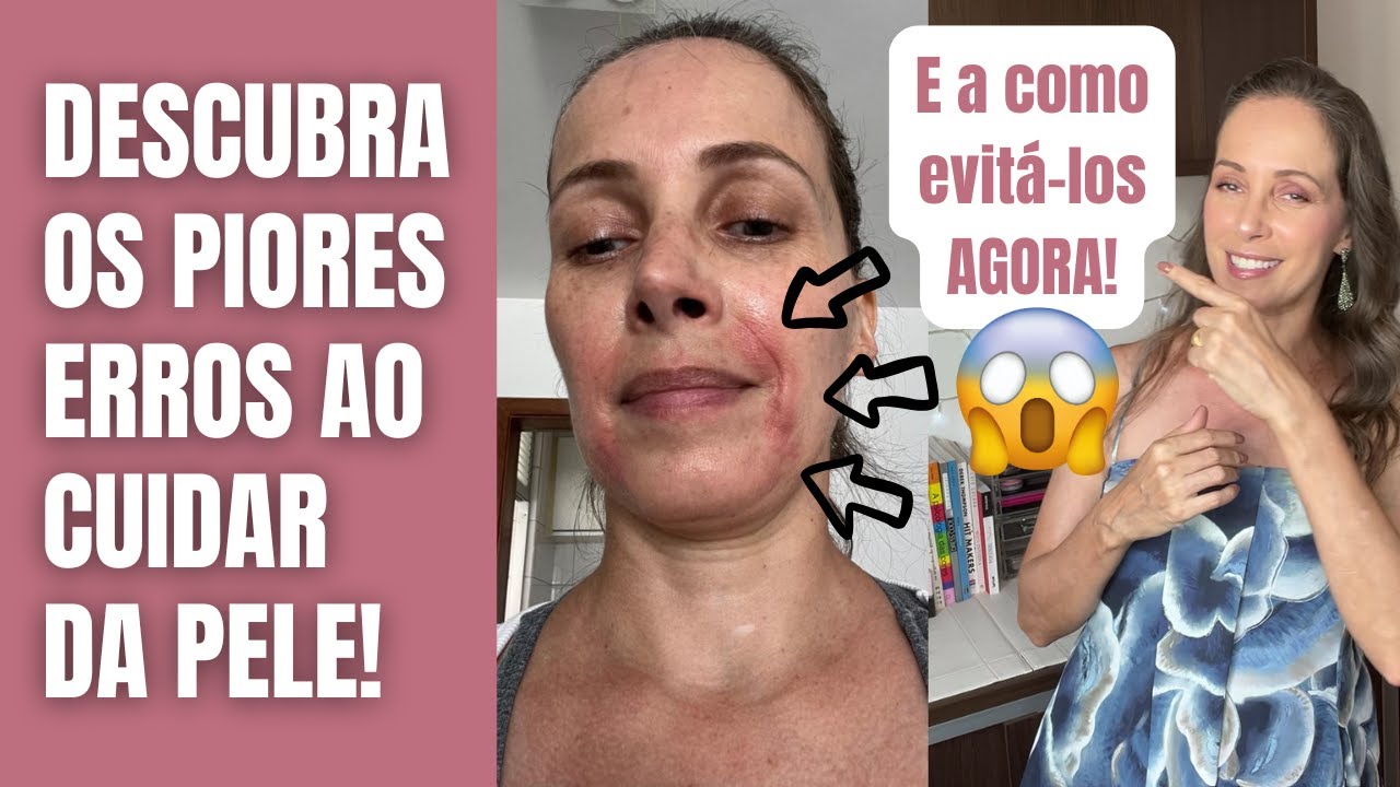 VOCÊ ESTÁ SABOTANDO SUA BELEZA SEM PERCEBER! Ana Penzin