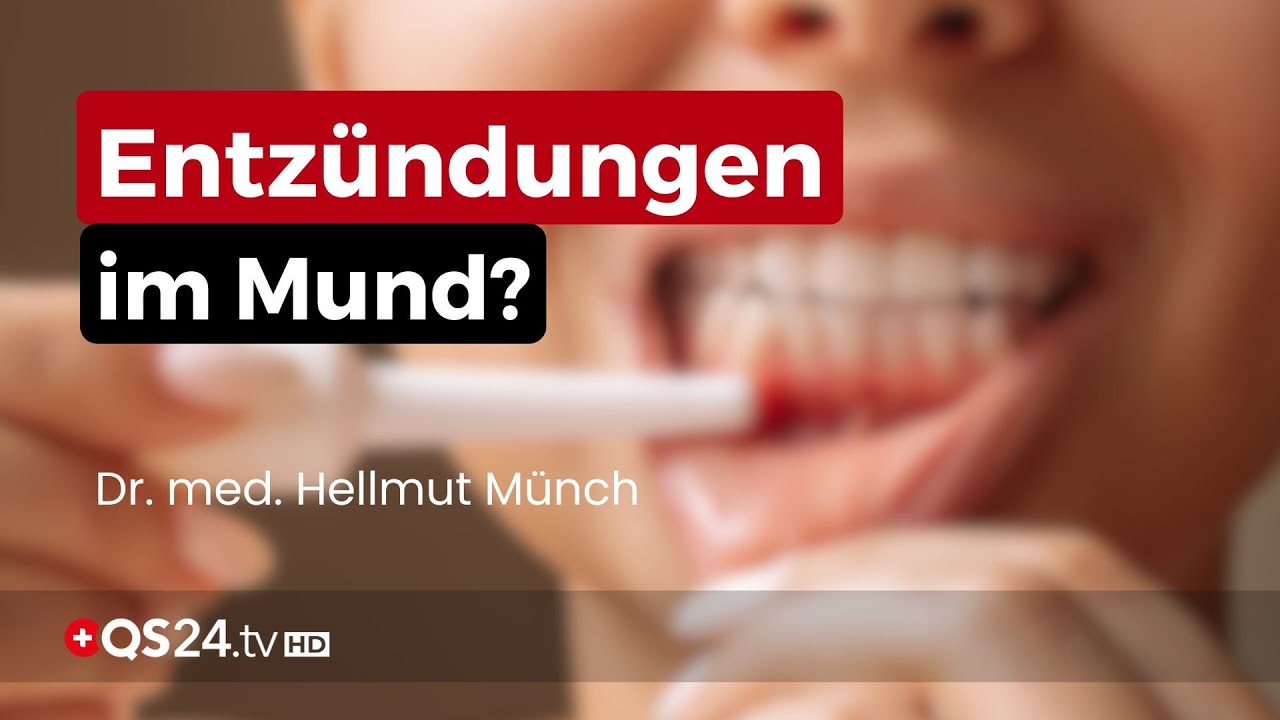 Parodontitis und die Rolle von Enzymen in der Mundgesundheit | Naturmedizin | QS24
