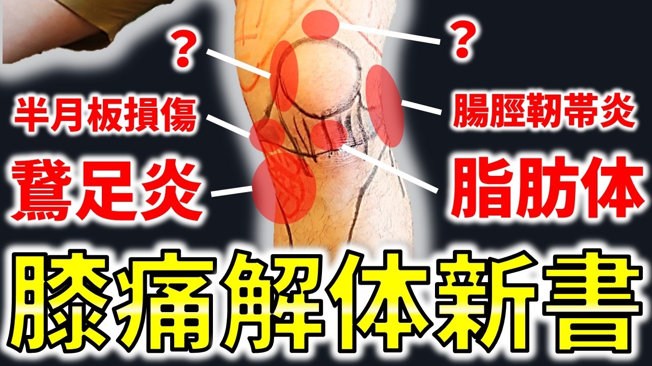 一目で原因がわかる！『膝痛解体新書』