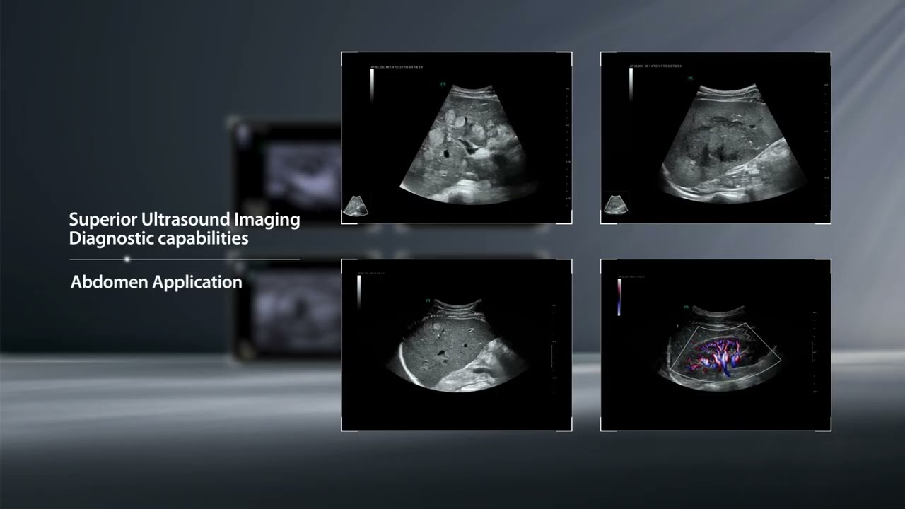 Resona A20 Premium Ultrasound System - reveal what matters