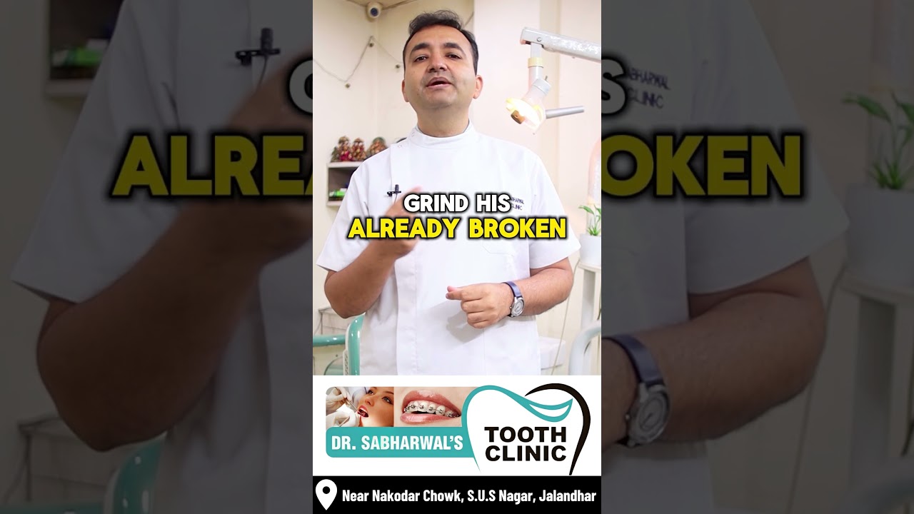 Broken Front Teeth Treatment | Broken Tooth Veneers | Dr Varun Sabharwal | Best Dentist In Jalandhar