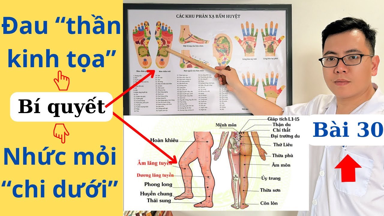 ĐAU THẦN KINH TOẠ, giải ph&aacute;p triệt để, hiệu quả tức th&igrave; | Ds Nguyễn Quốc Tuấn