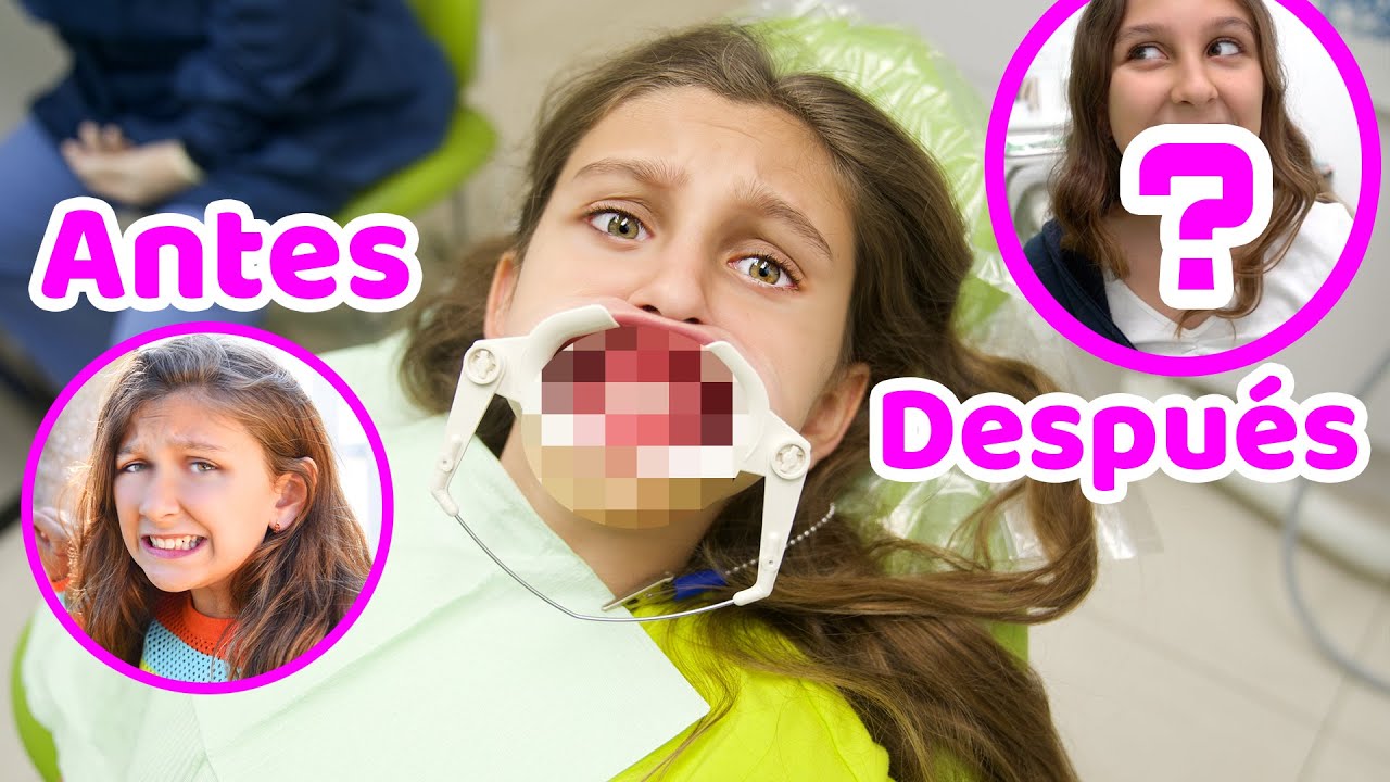 POR FIN! Me quitaron los BRACKETS! Antes y Después - Mimi Land