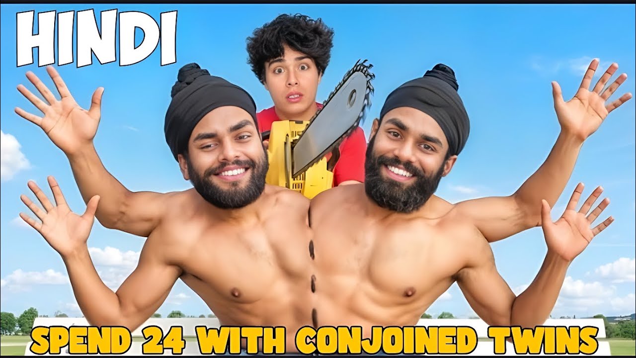 I Spent 24 Hours With Conjoined Twins in Hindi || Stokes Twins in Hindi || 