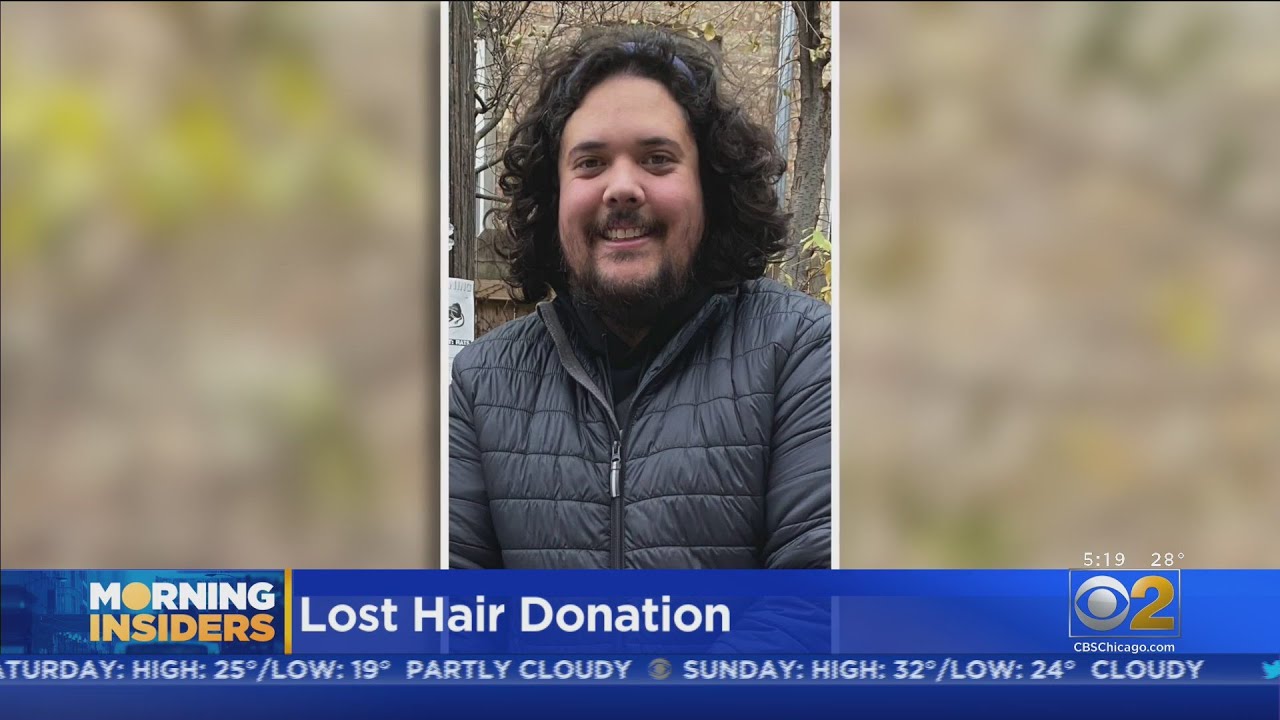 Chicago Man Takes A Year To Grow Hair To Donate To Cancer Patients, Only To See It Lost In Shipping