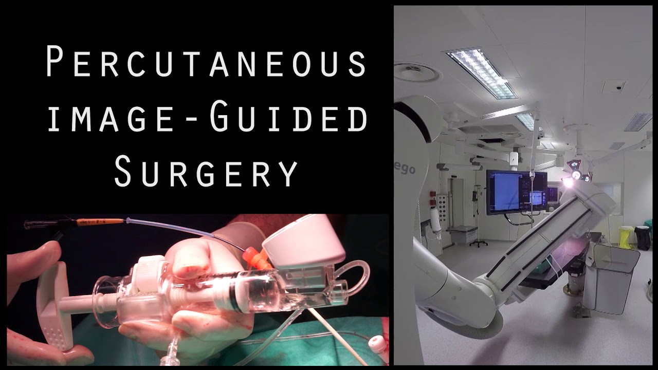 Image-Guided Surgery Week in April 2018