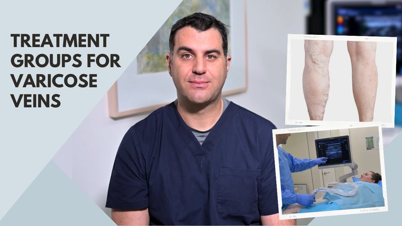 Treatment Groups for Varicose Veins with phlebologist Dr Peter Paraskevas