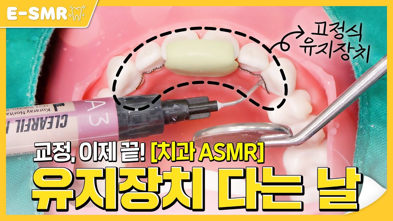 교정 언제 끝나요? 곧 끝나요~♪♩ 이제 유지장치를 붙여보아요! [치과 ASMR]