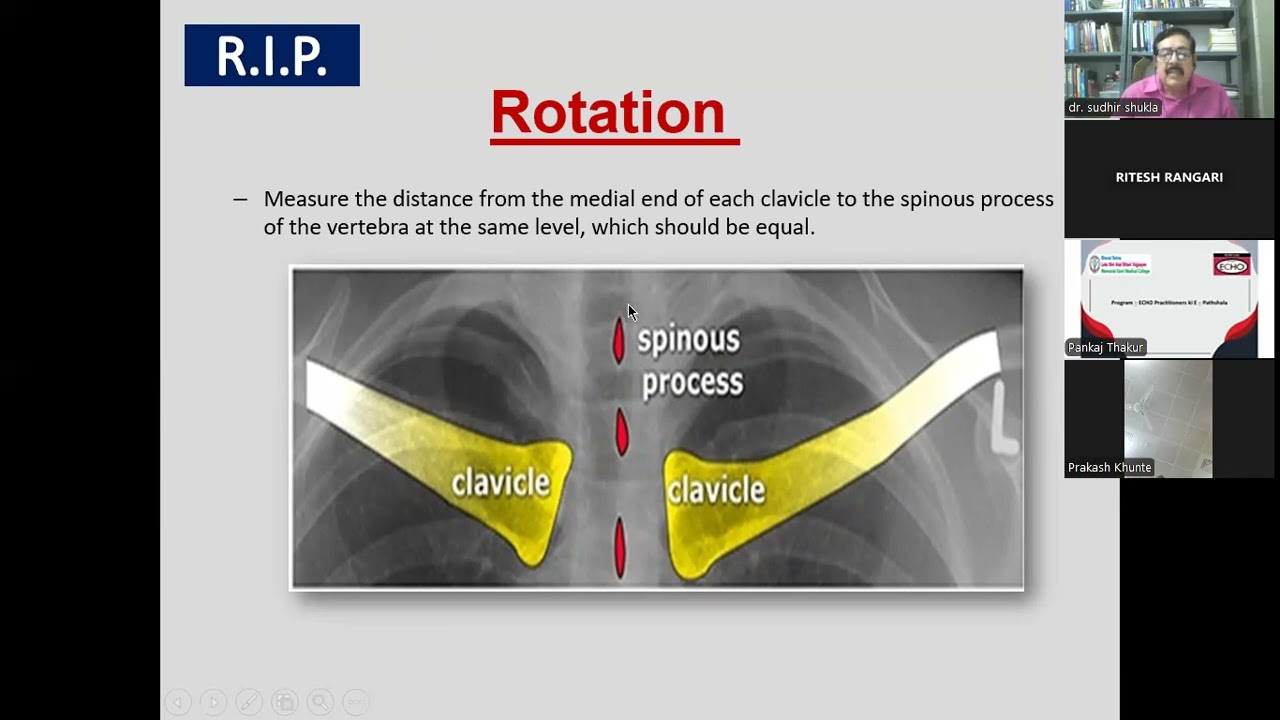 How to read chest xray GMC Rajnandgaon confrance