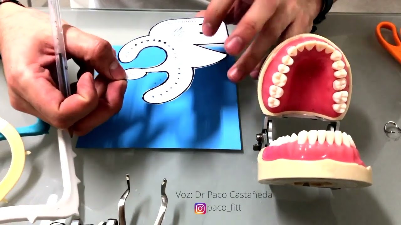 Aislamiento dental con PacDam