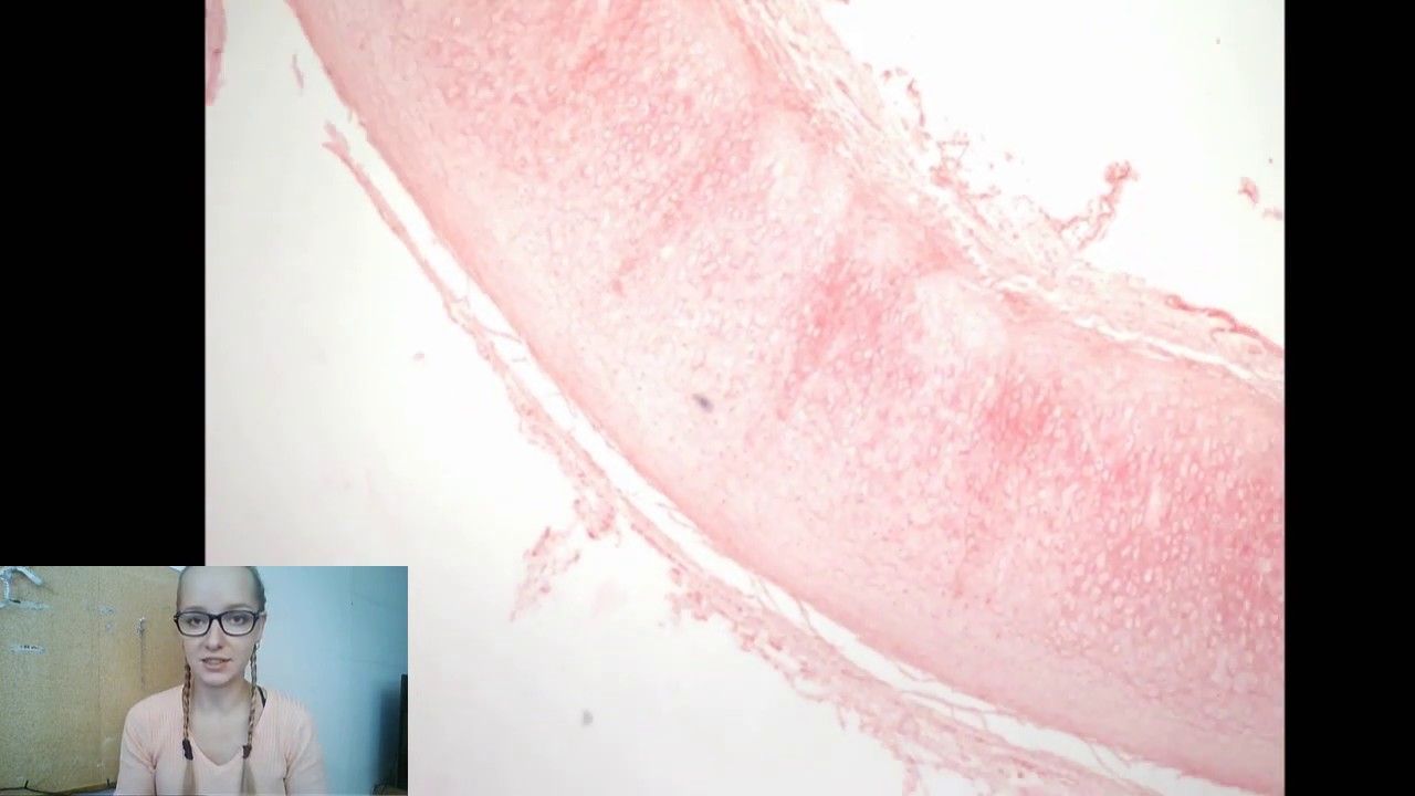 Chrupavka hyalinná, elastická, väzivová. Histológia