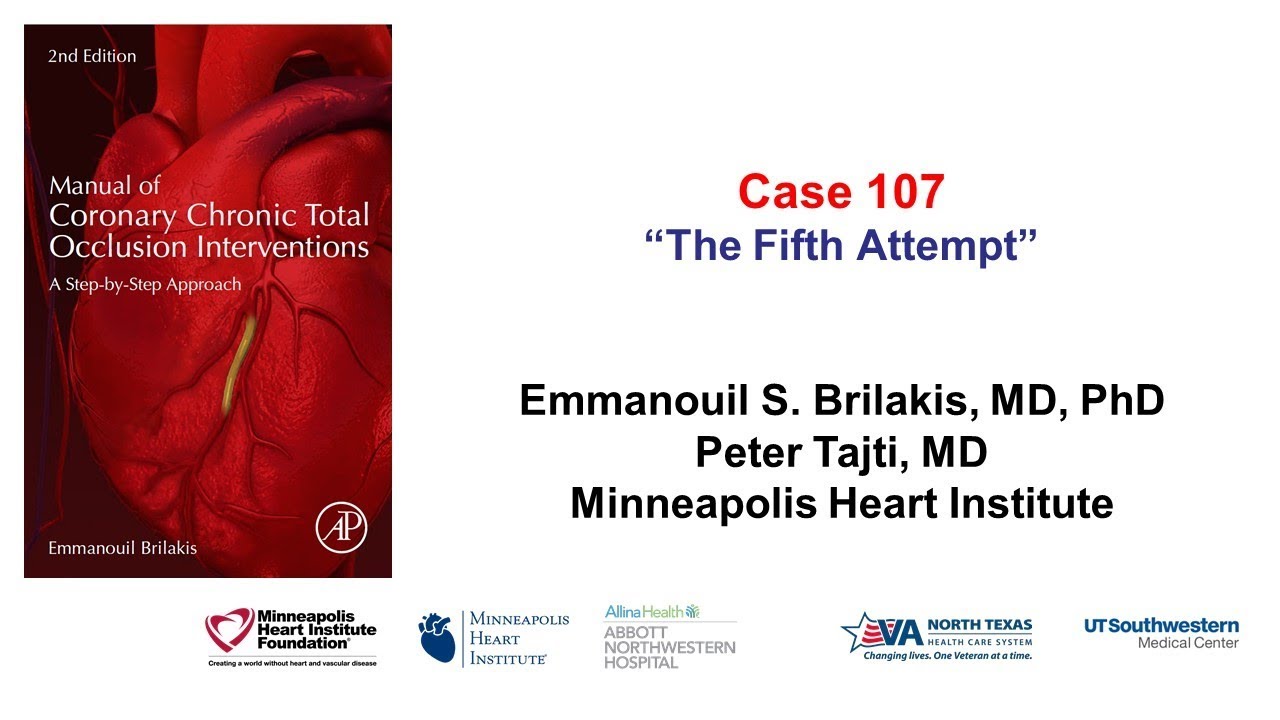 Case 107: Manual of CTO Interventions - The Fifth Attempt
