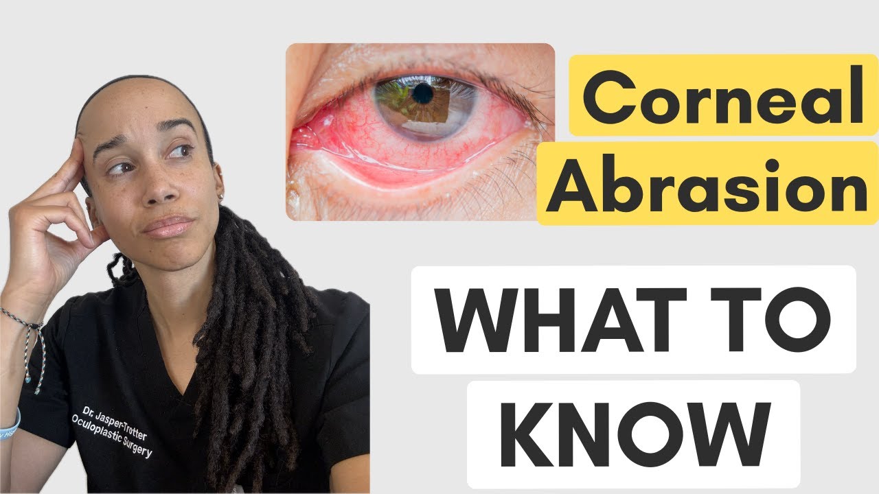Corneal Abrasion Mini-Course: Treatment, Red Flags, and When to Call Ophthalmology
