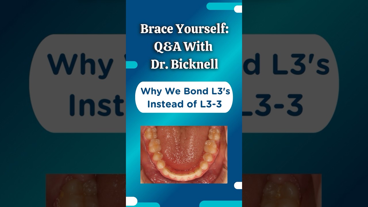 Why Bond L3's vs L3-3