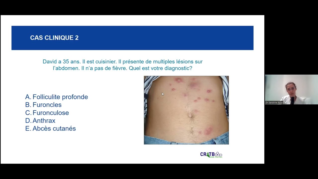 Webinaire infections cutanées bactériennes