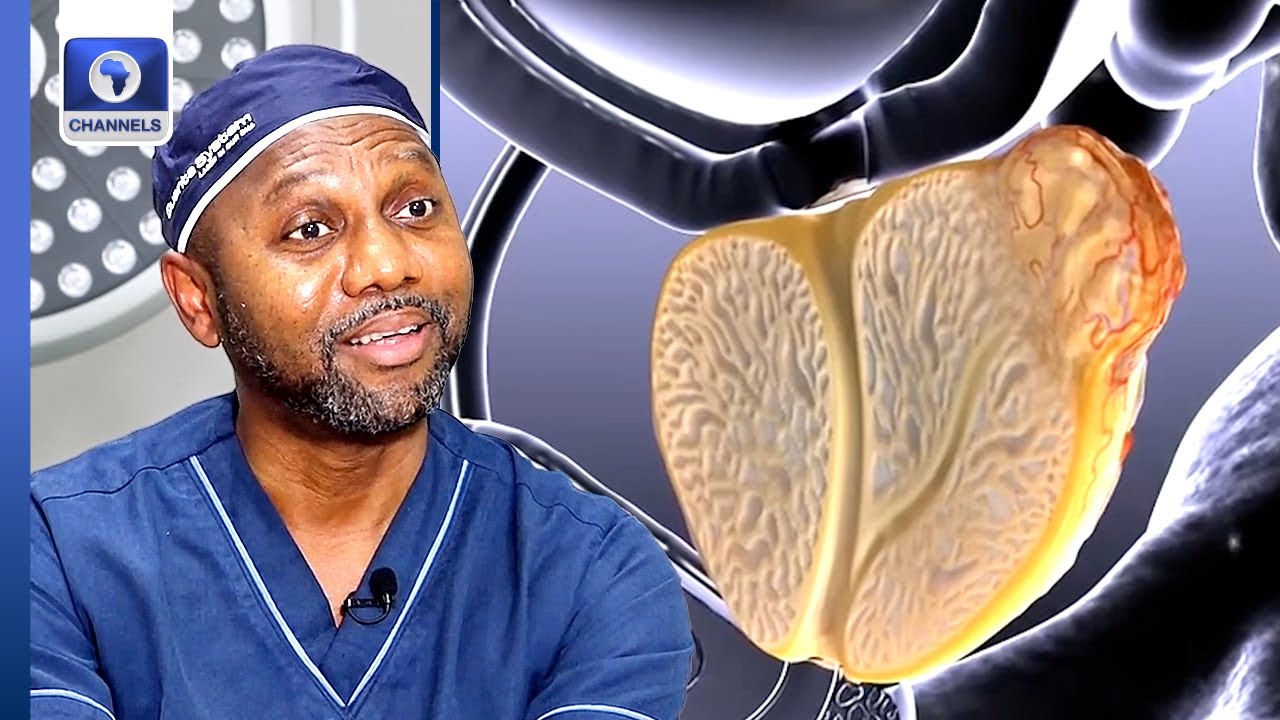Meet Prof. Kingsley Ekwueme, The Surgeon Who Cures Prostate Cancer With Robots | Amazing Africans