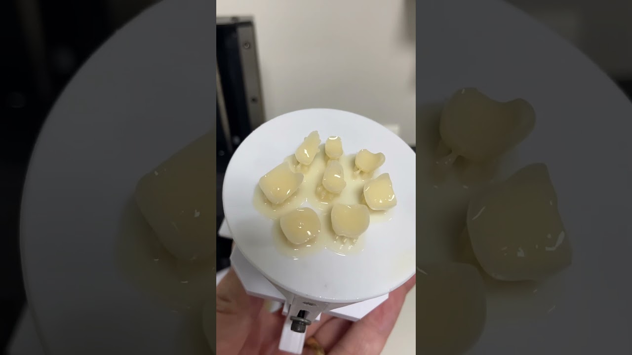 Reabilitação oral utilizando impressão 3D! 