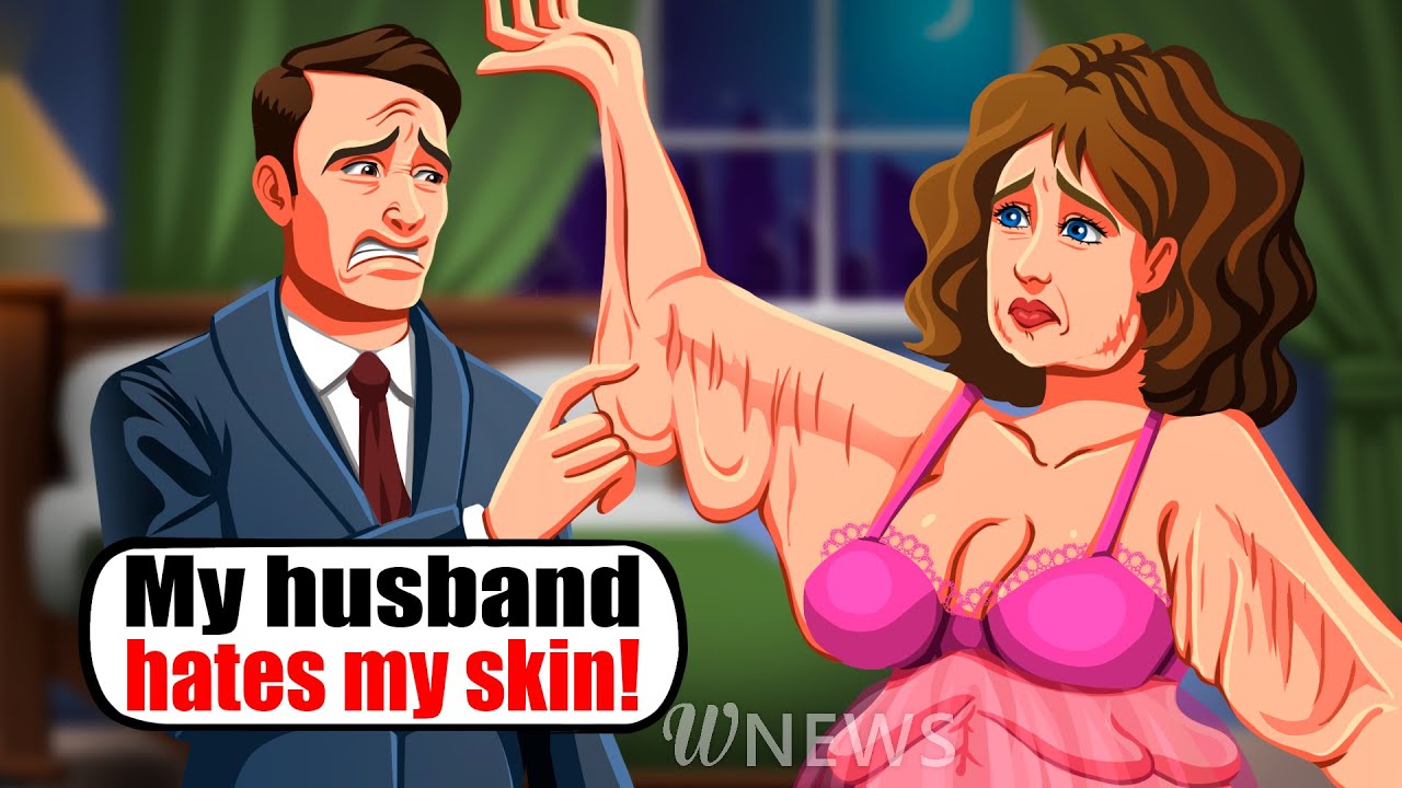 My husband hates my skin