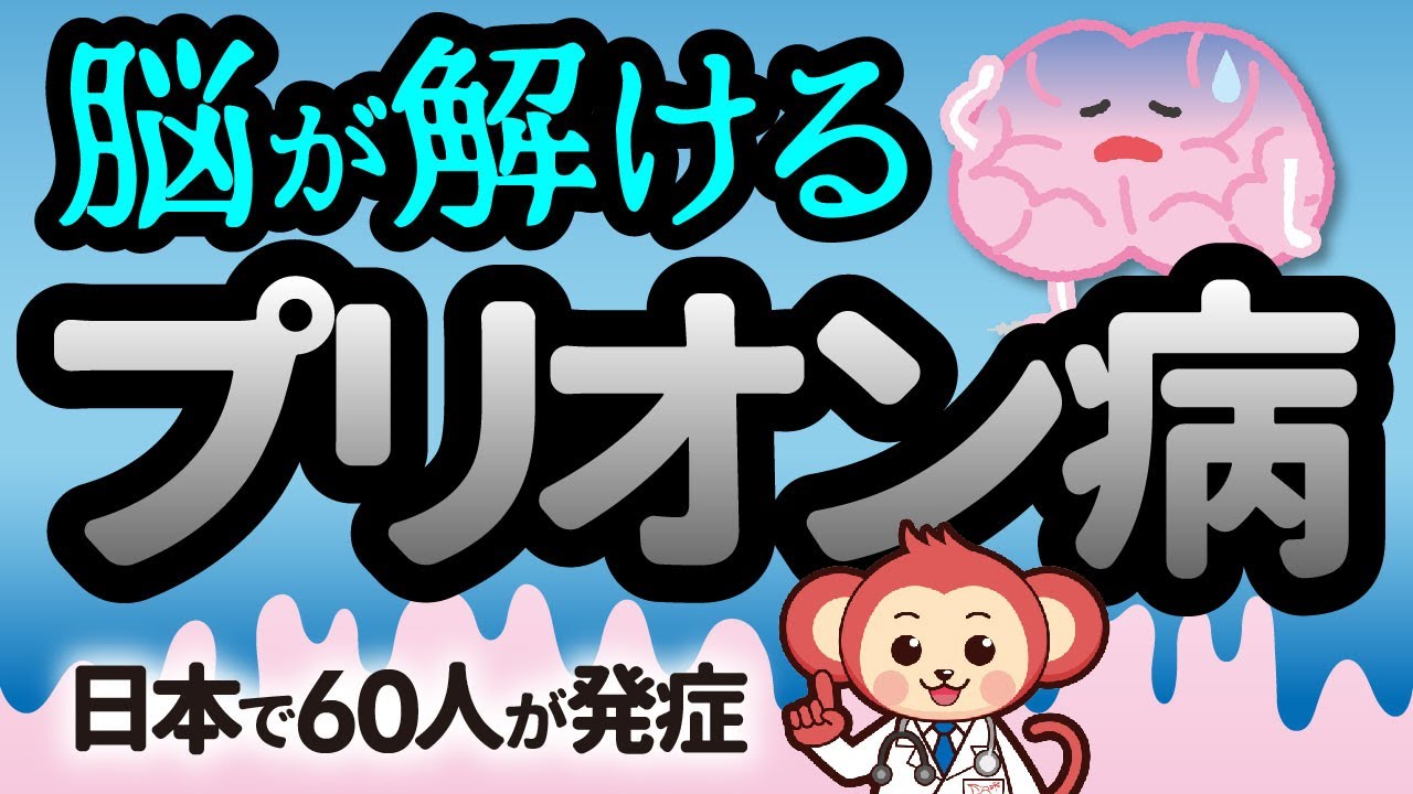 【衝撃】脳がスポンジになるプリオン病とは？合わせて狂牛病との違いも解説