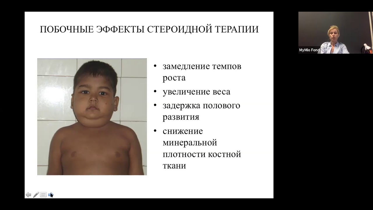 Пациенты с миодистрофией Дюшенна. Эндокринологические аспекты