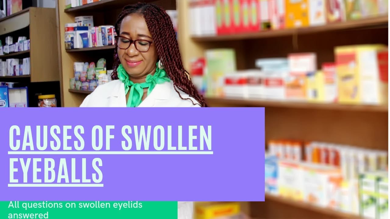 AMAZING HOME REMEDIES FOR SWOLLEN EYES-Part 2: Swollen eyeballs