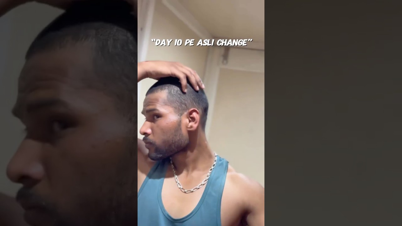 Day6–beard & hair nahi,mindset grow ho raha haiStruggle makesyoustronger 