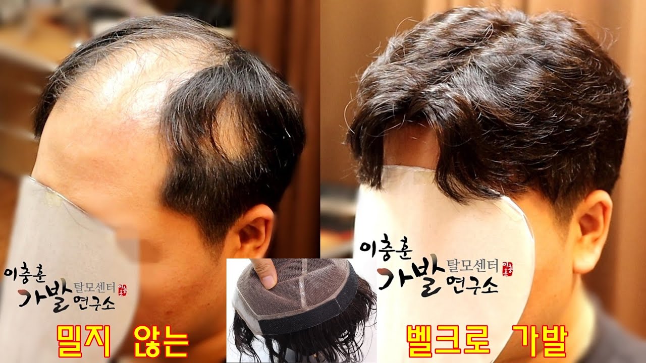 30대 정수리 부분가발 ( 밀지 않는 벨크로 )