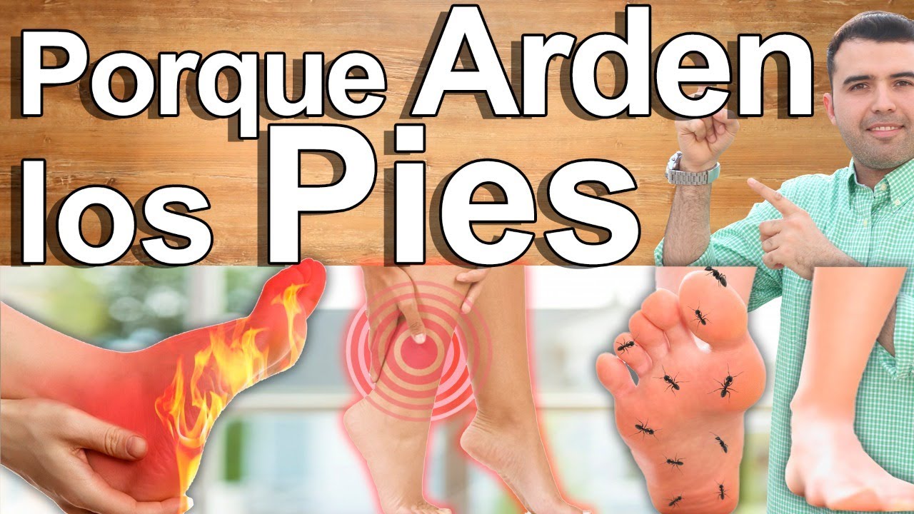 Porqué Me Arden Los Pies? - Causas Y Soluciones Para El Ardor Y Dolor En Los Pies