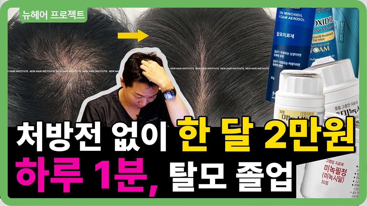 탈모 영양제 1년치 살 돈 아끼세요! '미녹시딜' 한 달 2만 원으로 끝내는 의사의 특급 처방