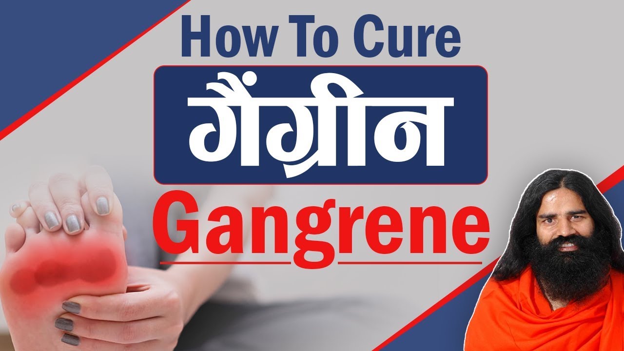 How To Cure Gangrene (गैंग्रीन) | Swami Ramdev