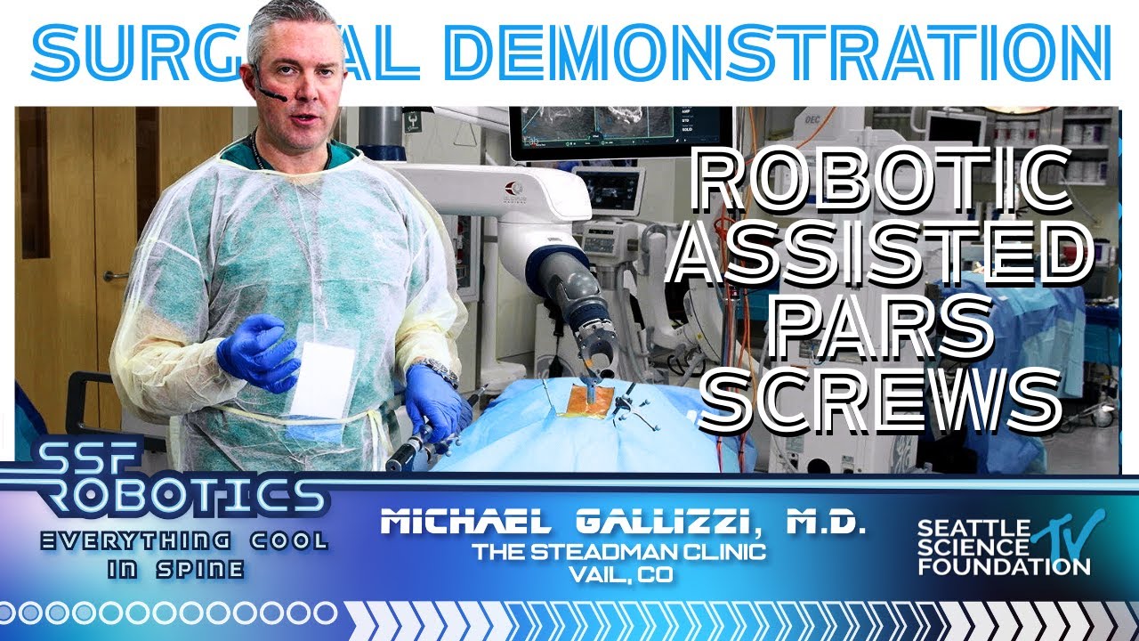 Surgical Demo: Robotic Assisted Pars Screws - Michael Gallizzi, M.D