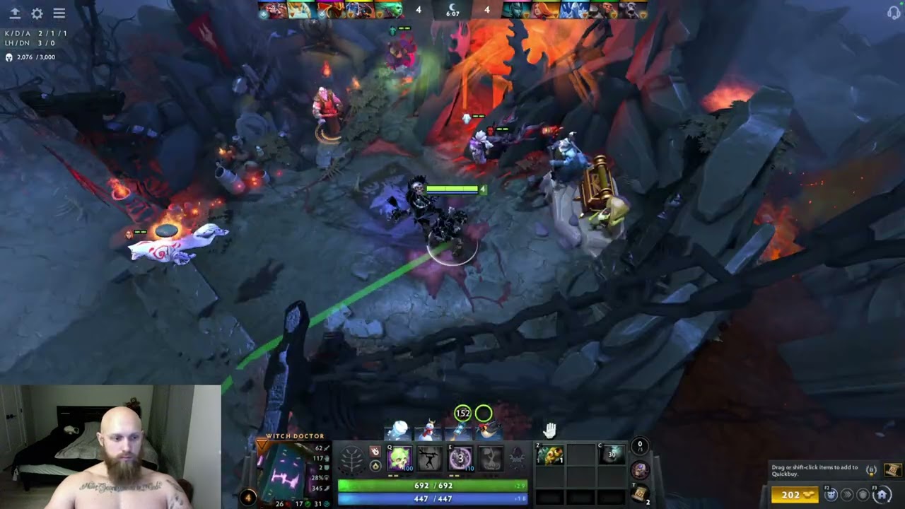 Dota 2 Witch Doctor