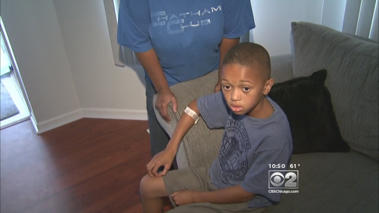 Former Olympian Saves 8-Year-Old Boy From Pit Bull Attack