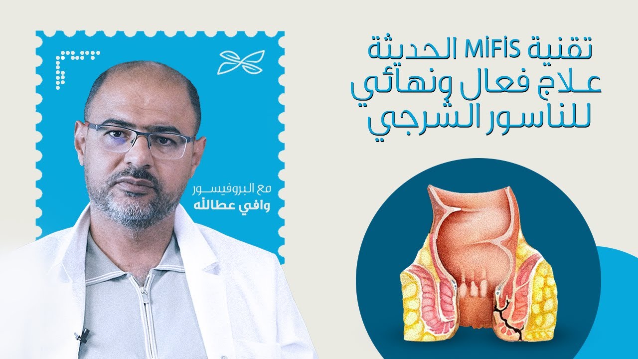 ماهو الناسور الشرجي | أحدث تقنيات علاج الناسور الشرجي في تركيا (MİFİS) مع البروفيسور وافي عطالله