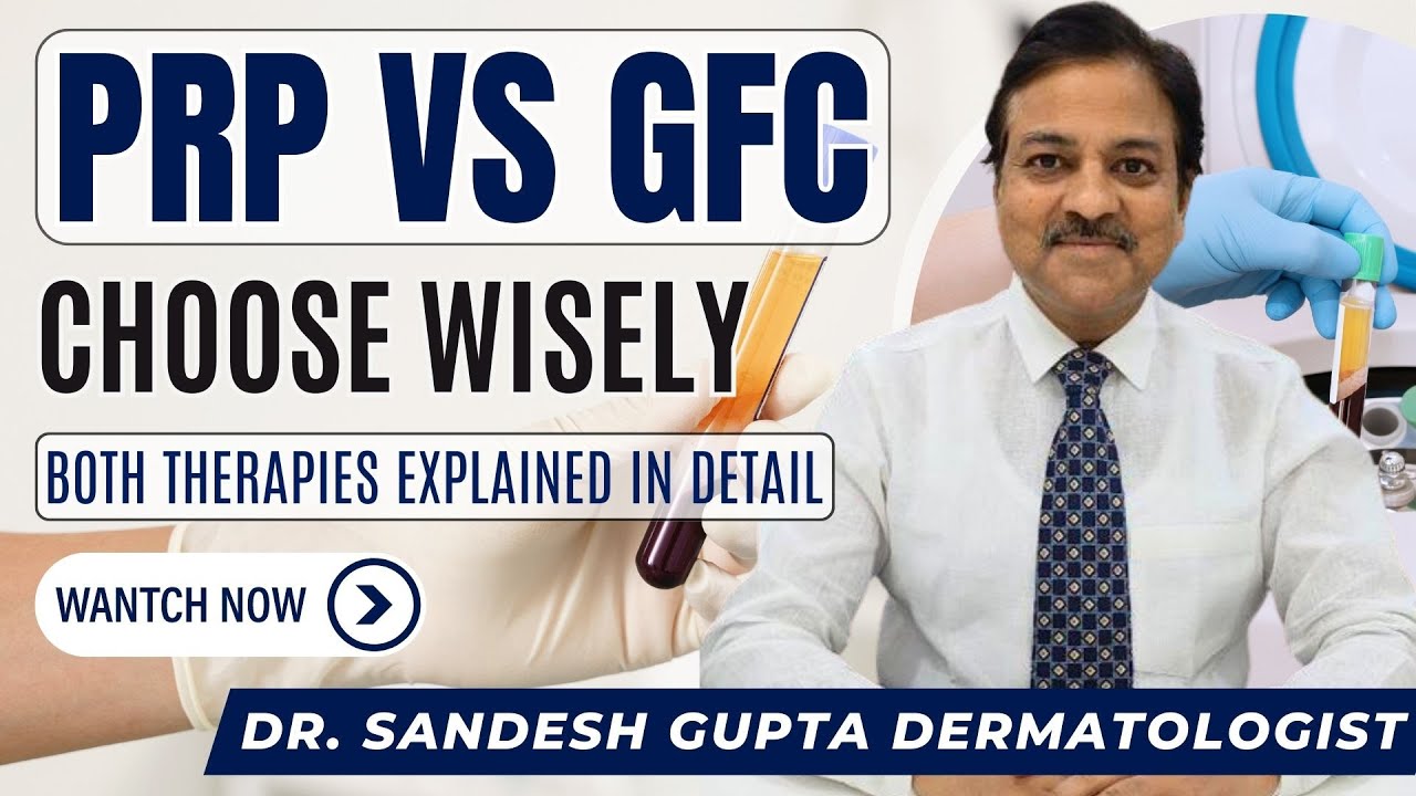 PRP VS GFC | Which One Should You Choose? Hairfall Solution | Hair Regrowth Formula By Dermatologist
