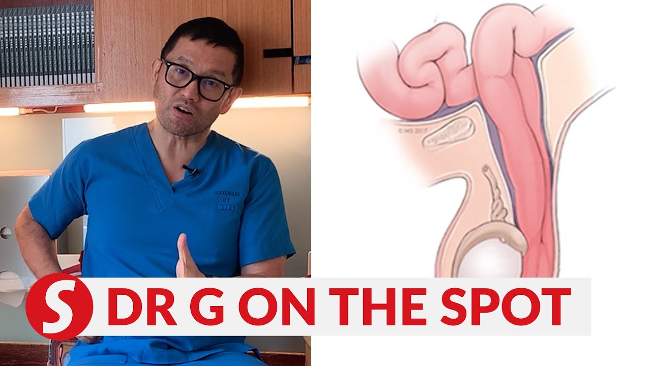 EP172: Herniating weakness and unwelcoming scrotal lump | PUTTING DR G ON THE SPOT