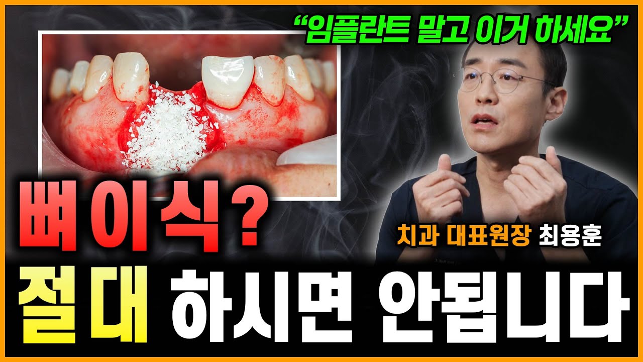 "임플란트 말고 이거 하세요" 뼈이식? 절대 하시면 안됩니다 (최용훈 원장님)