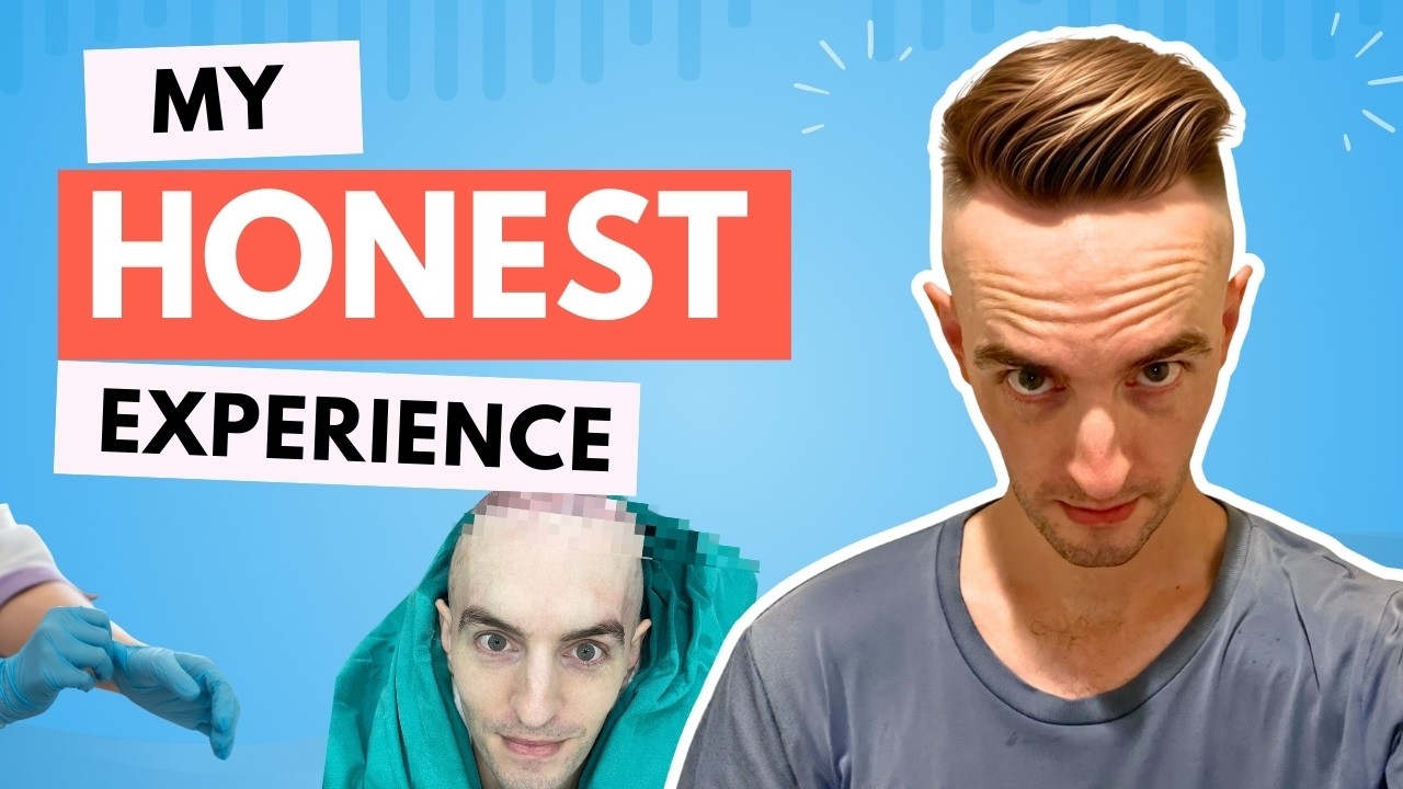 I Got a Hair Transplant...