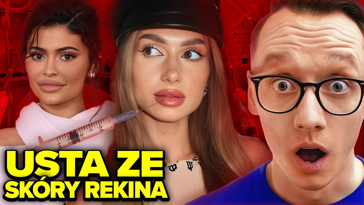 POWIĘKSZANIE UST MOŻE CIĘ ZA*IĆ? 💀 *MODA NA KACZE USTA*