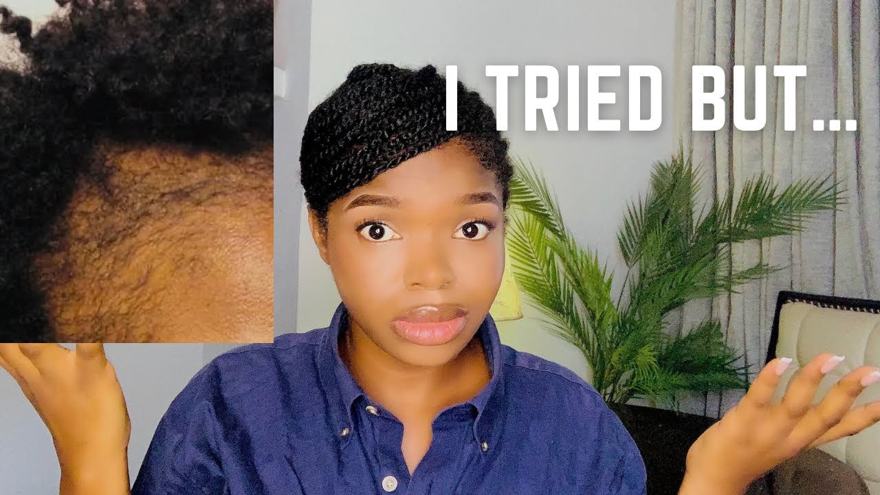 I Grew Back My Edges?!! You wouldn't Believe What I Did 😳