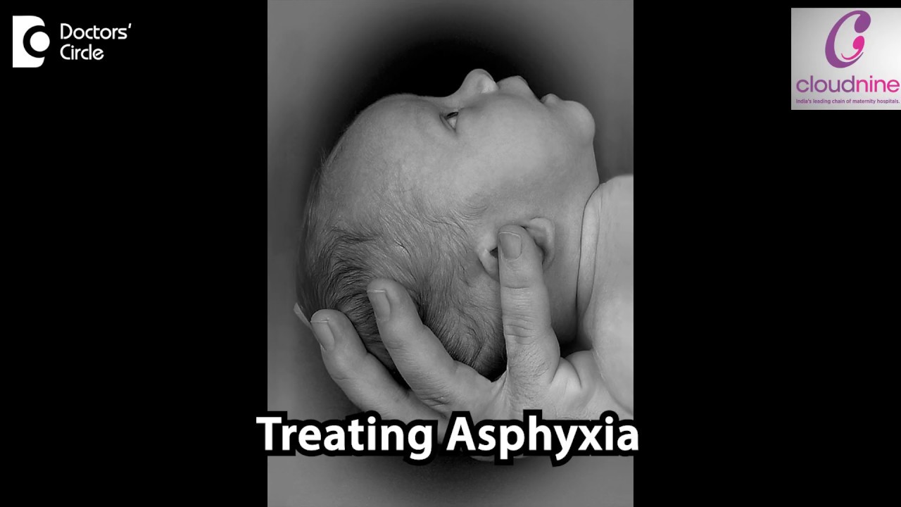 How do you treat Birth Asphyxia? - Dr. Piyush Shah of Cloudnine Hospitals | Doctors&rsquo; Circle