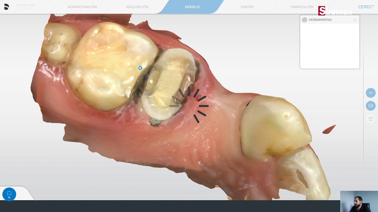 CEREC SW 5.1 Caracteristicas