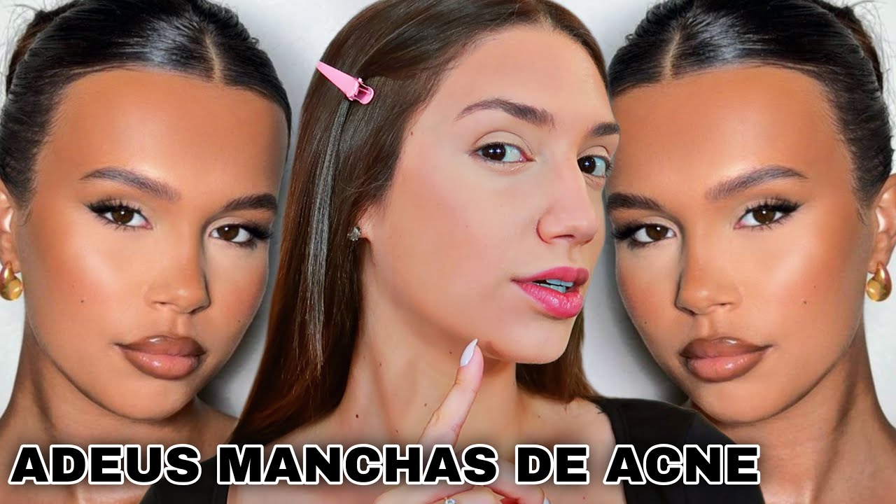 A pele PERFEITA para quem tem MANCHA DE ACNE | Como esconder manchinhas de acne!! TUTORIAL COMPLETO