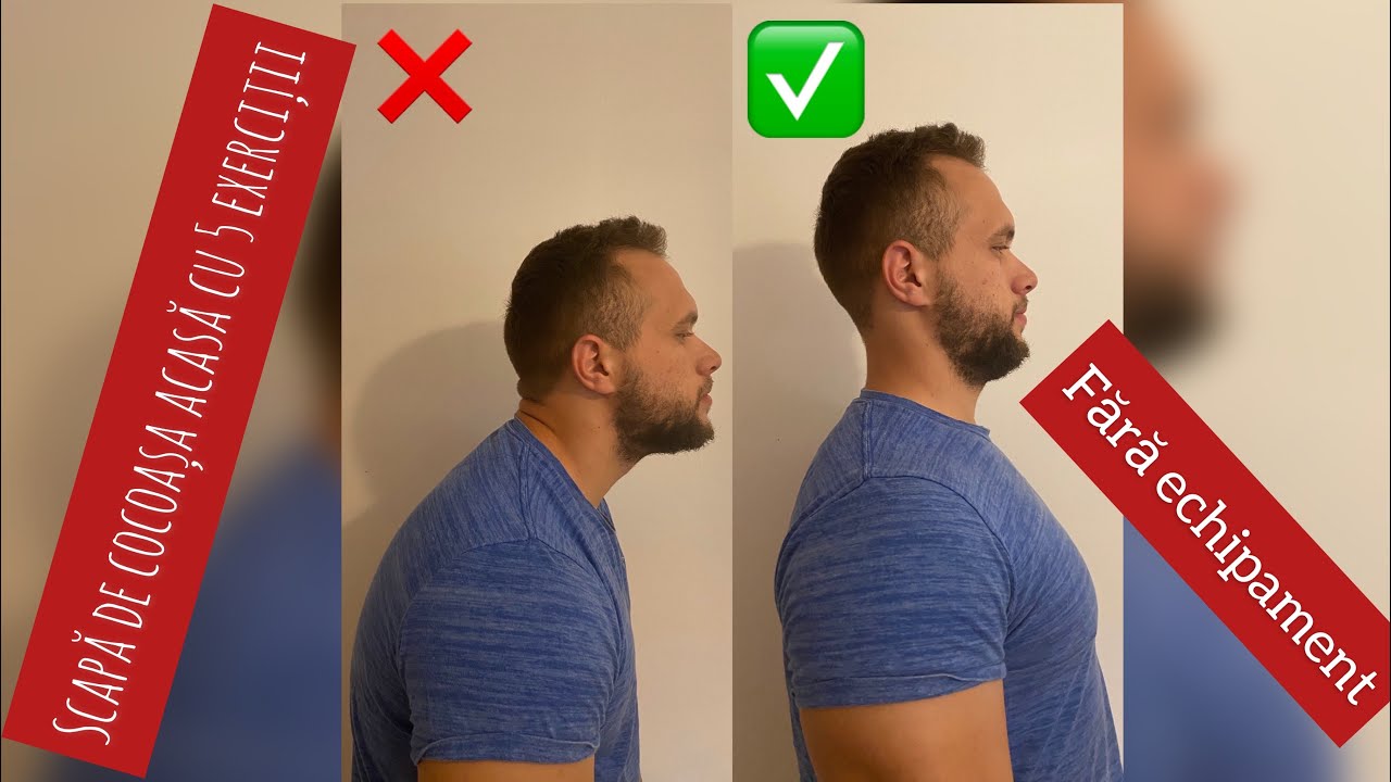 TOP 5 EXERCITII PENTRU O POSTURA CORECTA A SPATELUI (SCAPA DE COCOASA/CIFOZA ACASA FARA ECHIPAMENT)